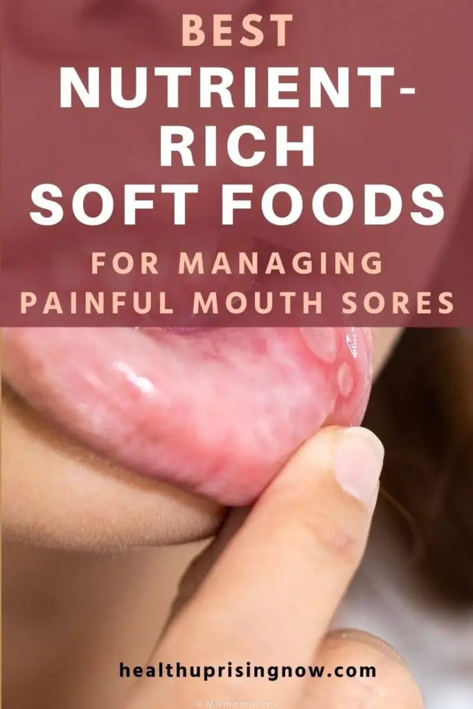 Best Nutrient-Rich Soft Foods for Managing Painful Mouth Sores